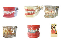-Teeth-and-Study-Models-xt.jpg